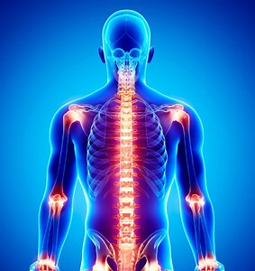 SOD1, SOD2, and SOD3 Genes: Unlocking the Link to Arthritis