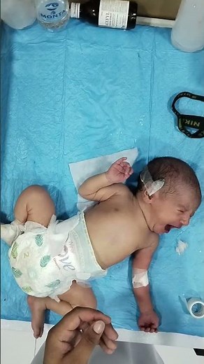 NICU Baby Blood Sample Collection & Gentle Care | Newborn Monitoring in baby journey in our NICU