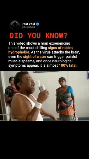 The incurable stage of RABIES.