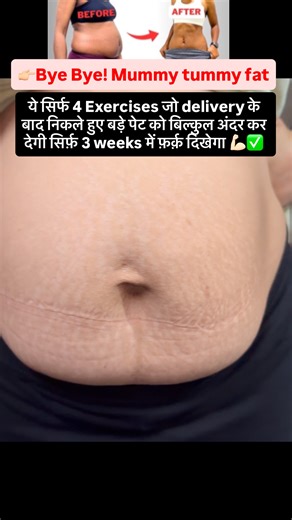 Advance Paradise on Instagram: "Working on that mummy tummy with love, breath and control 💪🏻✅. This is a gentle core workout for Diastasis recti healing ✅Engage your core- don’t push the belly out ✅Exhale while lifting or moving ✅Move slowly, breathe mindfully No crash workouts, just mindful healing Dm us for online classes Get fit with @advance_paradise . #mummytummy #fatloss #gymmotivation #fitmom #fitnessmotivation #bodyfitness #diastasisrecti #weightloss #gymgirl"