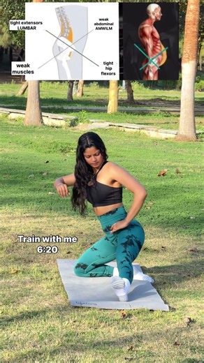 This is a typical muscle imbalance in the pelvis and lower back #shorts #hipmobility #mobility