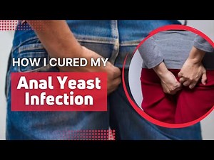 Best Way to Cure Anal Yeast Infection