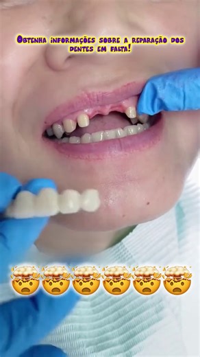 Invisible braces explained: what to know before treatment – Learn more | Tommy Tips