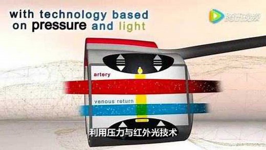 CNAP无创每搏连续血压及血流动力学监测技术