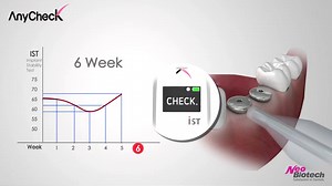 AnyCheck - Implant Stability Tester
