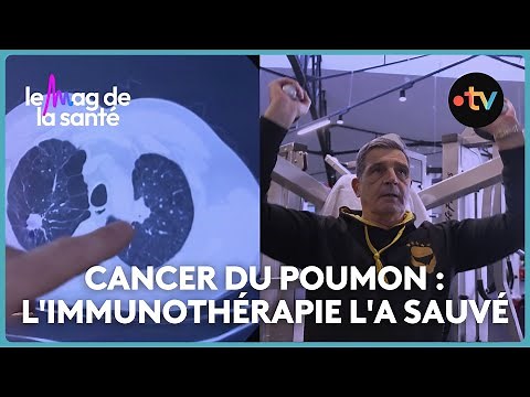 Cancer : comment l'immunothérapie a révolutionné la prise en charge des patients