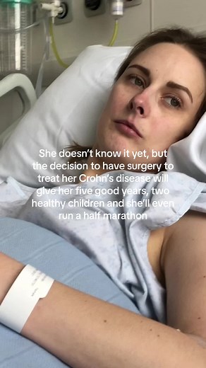 Facing Crohn's Disease: A Life-Changing Surgery Journey