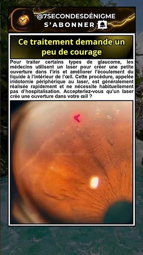 Laser dans l’œil