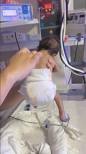 ¿Cómo se llama este reflejo?🚼