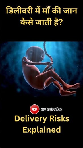 Delivery Time 3 Biggest Dangers for Mother | Must Watch for Every Husband ❤️ #pregnancy #delivery