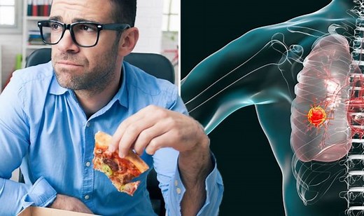 Do you experience 'Dysphagia’ when eating? It could signal lung cancer