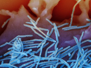 There’s a New Life-Saving Vaccine. Why Won’t People Take It?