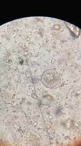 180K views · 1.5K reactions | Stool wet mount prep ❤️. | Lab life | Facebook