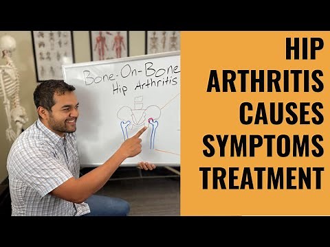 Everything You Need To Know About Bone On Bone Hip Arthritis