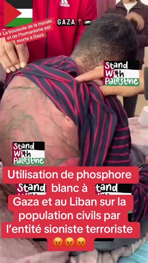 Vidéos de French woman human ❤️ (@frenchsmartboldwoman) avec son original - French woman human ❤️