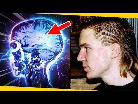 He woke up a genius after a beating! And science can't explain it.