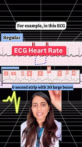 Learn ECG basics with me 🩺 #ecg #ecginterpretation #cardiologia #cardiology #medicalstudent #medicine #doctor #mbbs #mbbsstudent #mbbsexams #neet #neetpg #neetug #neetexam #neet2024 #neet2025preparation | Dr Alvina Zanib
