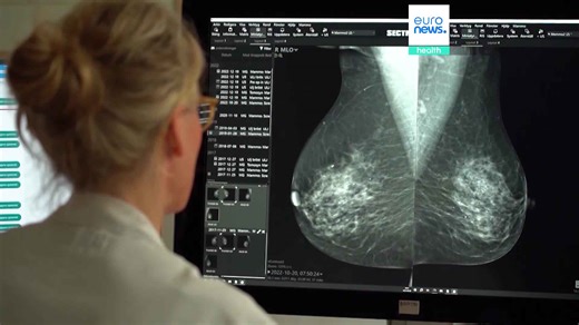 Breast cancer: What you need to know about detection, risks, and screening