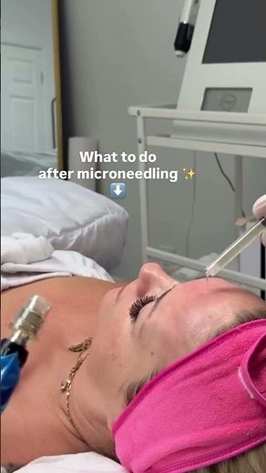 What to do After Microneedling ⬇️