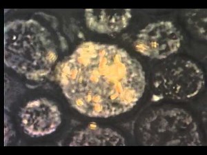 A demonstration of very active gold nanorods internalized inside HeLa cells in an acoustic field.