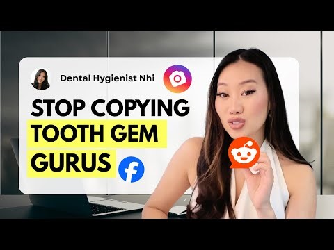 my EXACT blueprint for 2 year tooth gem retention (copy me)