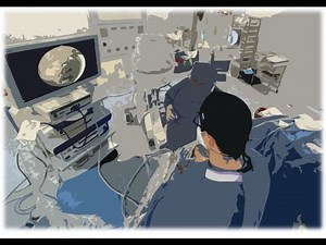 L4-L5 left Synovial Cyst