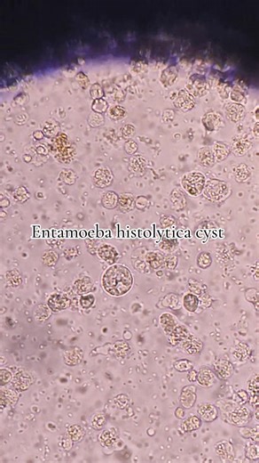 TikTok · Jia Aira Lyn, RMT