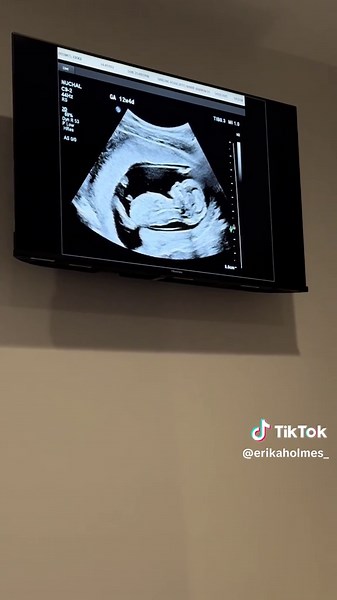 13 week ultrasound scan, the most surreal experience 👶🏽 #13weeksultrasound #pregnancy #13weekspregnant