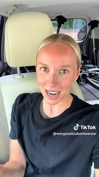 Removing SureSmile Invisible Braces for Wedding | Braces Off