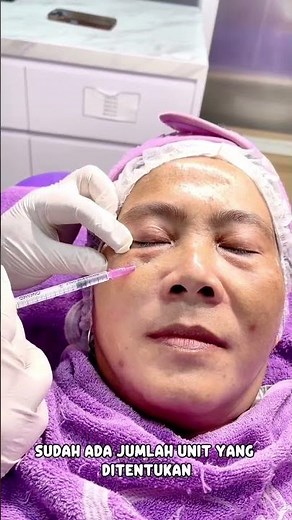 Mata sayu dan kantung mata bikin wajah terlihat lelah? 😫 #skincare #skincareroutine