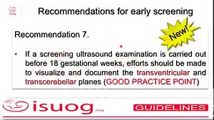 Watch Prof. Dario Paladini summarizing the recently published #ISUOG guidelines on the sonographic examination of the fetal CNS (part 1). You can access freely the guidelines from this link https://bit.ly/2NLu6KB #UOGjournal | International Society of Ultrasound in Obstetrics and Gynecology (ISUOG)