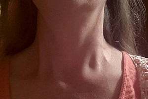 Enlarged lymph nodes, when to consult a doctor? | Emergency Live