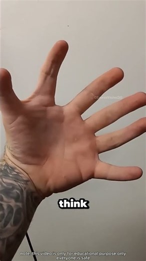 What happens when you are born with 6 fingers? #medical #curiosity