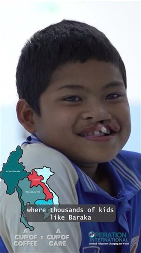 GIVE A CUP OF CARE: Operation International's Cleft Lip Repair