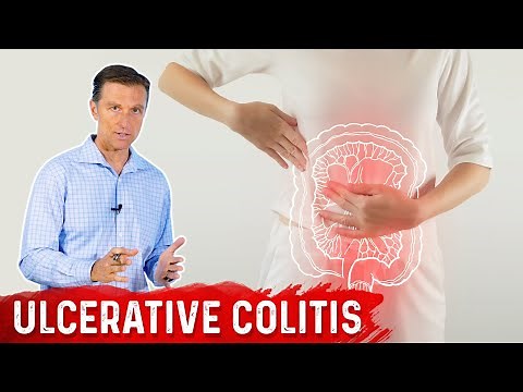 What is Ulcerative Colitis? – Causes, Symptoms & Treatment by Dr.Berg