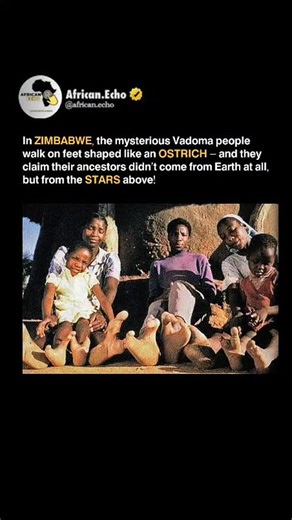𝐓𝐇𝐄 𝐄𝐂𝐇𝐎 𝐅𝐑𝐎𝐌 𝐀𝐅𝐑𝐈𝐂𝐀 🗣️🎙️ | The Vadoma (or Doma) people of Zimbabwe are known for ectrodactyly, a genetic trait causing "ostrich-like" feet with fused toes. Folklore... | Instagram