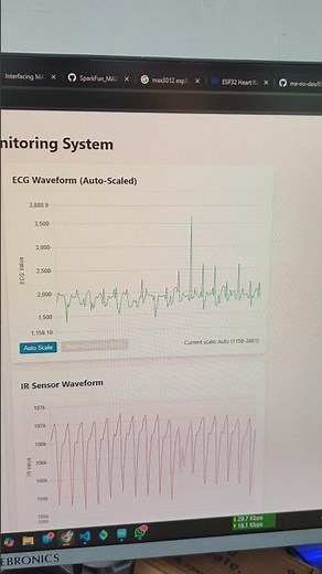 Heart attack monitoring system using esp32 #esp32 #arduino #ad8232 #max #project #iot #college