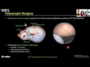 What is Fetoscopic Surgery?