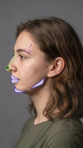 What Makes a Face Beautiful? | Facial Proportion & Harmony Analysis