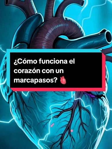 ¿Qué es un marcapasos y como funciona? Descubrelo... #marcapasos #corazon #cuerpohumano #heartproblems #ciencia