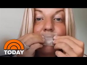 Medical Providers Warn Of Health Risks With Viral Mouth Taping Trend