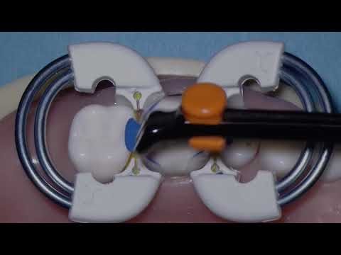 How to use the new Bioclear Adjustable Push Pull Instrument