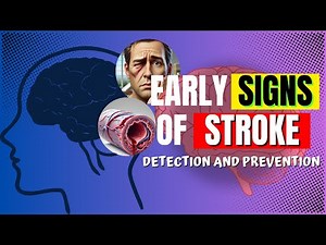 Early Signs of Stroke! How to Detect and Prevent!