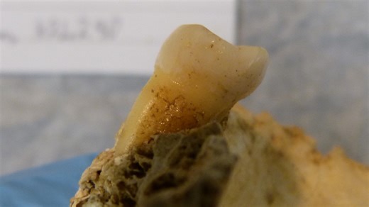 Decay bacteria in ancient molars found in Limerick cave