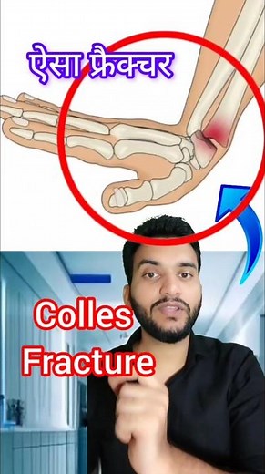Colles fracture vs Smith's Fracture