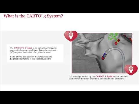 ABSMC CARTO 3 System