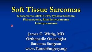 Soft Tissue Sarcomas: Clinical, Radiographical, and Pathological Features