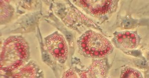 Researchers discover how to fight fat ... with fat