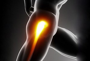 Mako Robotic Assisted Hip Replacement - Florida Ortho Care