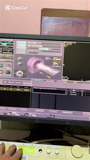 #creatorsearchinsights #MRI #CTSCAN #foryou #teaching chest ct scan